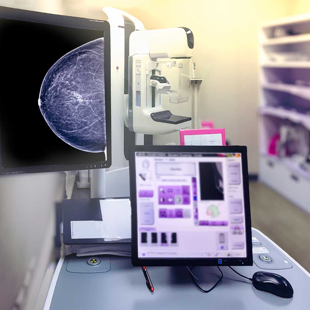 Breast Imaging Suite