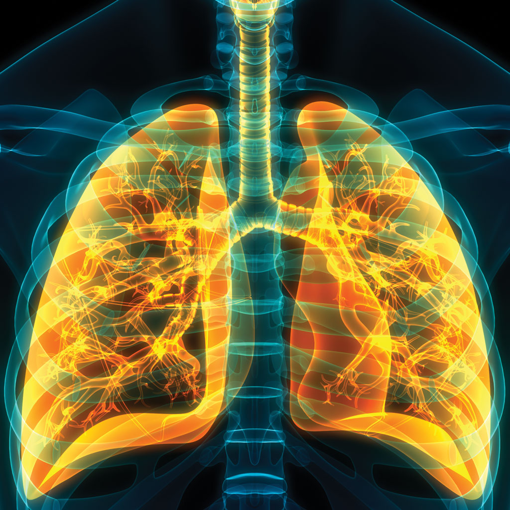 Reasons to Consider a Lung Screening Render