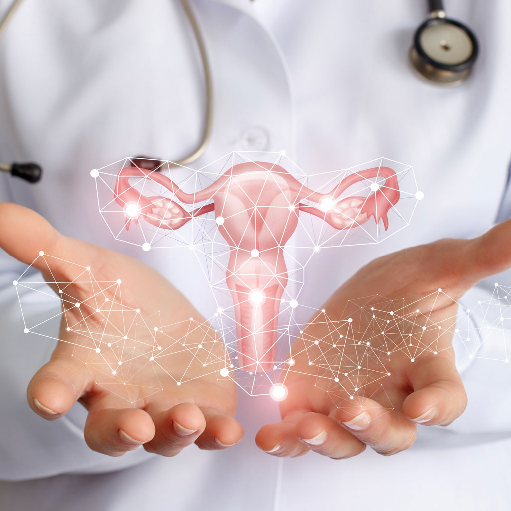 Uterus Render Is a Hysterectomy Really Necessary